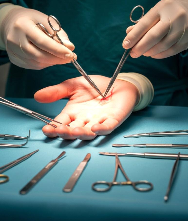 Hand Surgery Precision: Repairing Tendons and Nerves